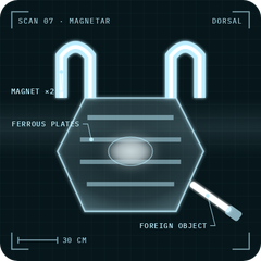 Magnetar: X-ray scan